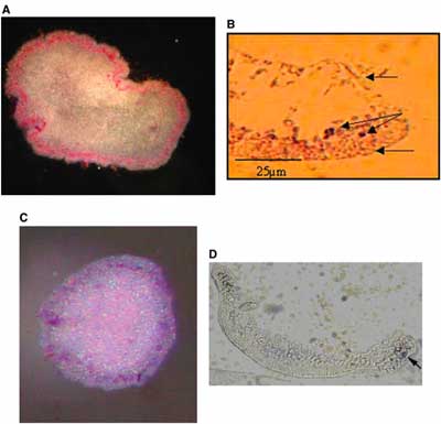 trichoplax